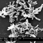 1200px Clostridium difficile 01