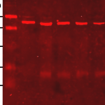 Anti lipoic acid immunoblot